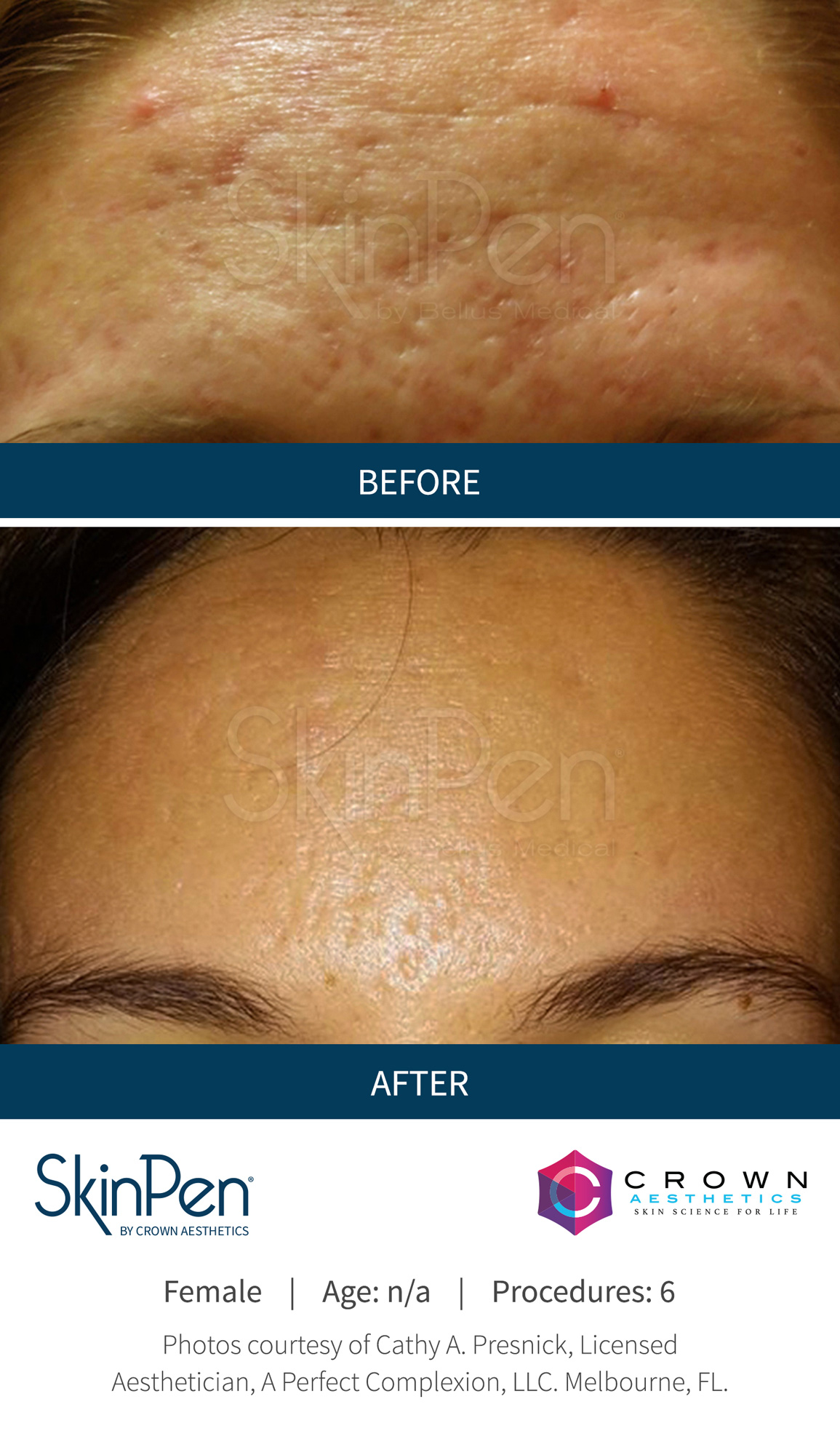 eDermastamp Broadstairs