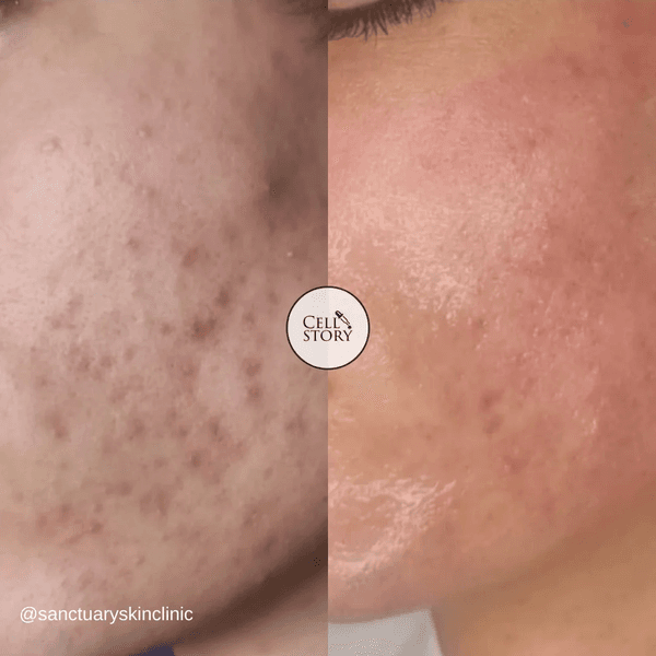 eDermastamp Broadstairs