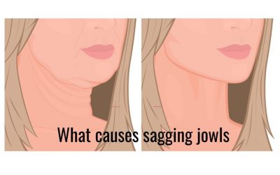What is the best treatment for sagging jowls?
